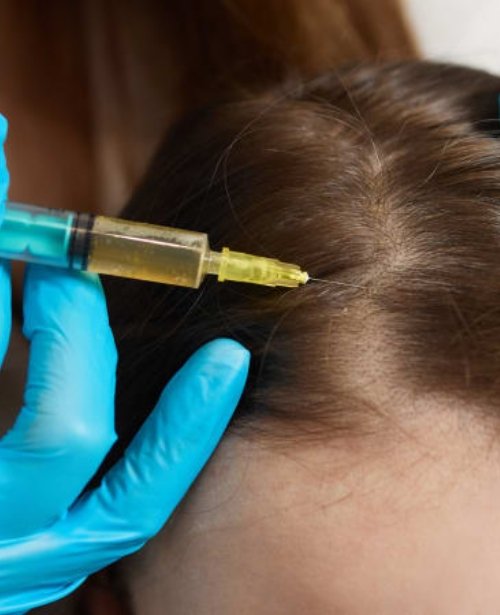 PRP (Platelet-Rich Plasma)