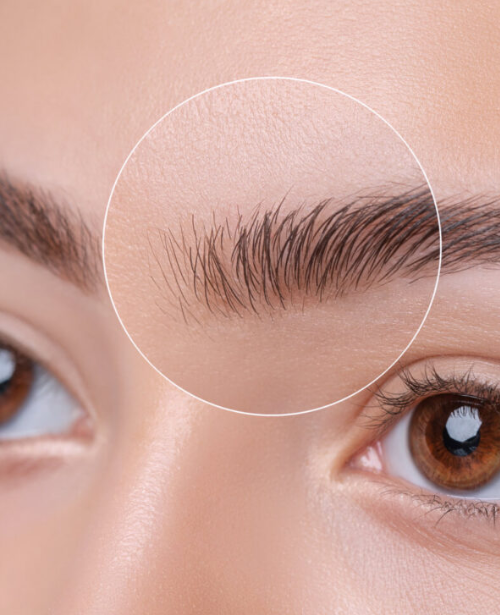 Partial Brow Restoration