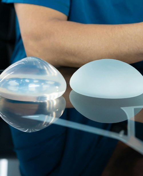 Implant Based Re-construction