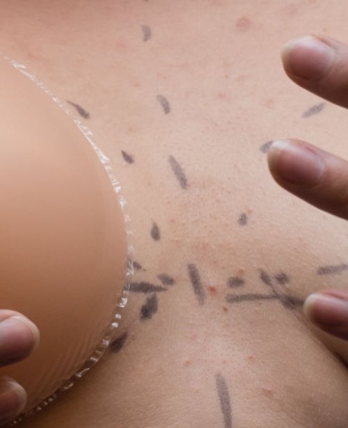 Size or Shape Adjustment