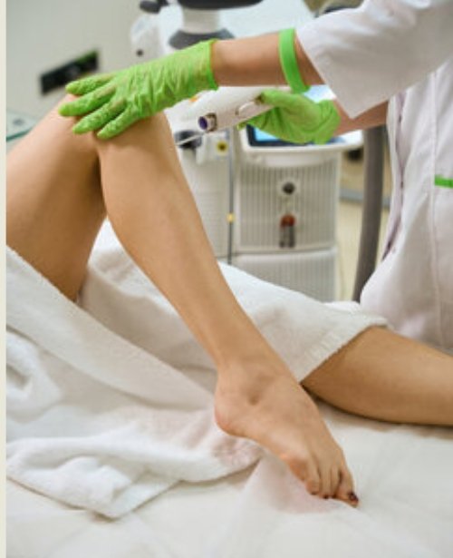 Laser Vaginal Rejuvenation