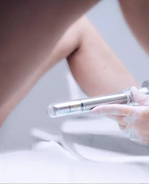 Laser or Radiofrequency-Assisted Vaginoplasty