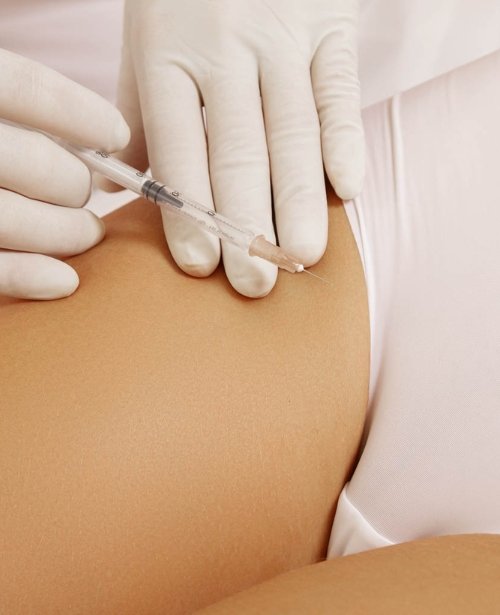 Hyaluronic Acid Filler G-Shot