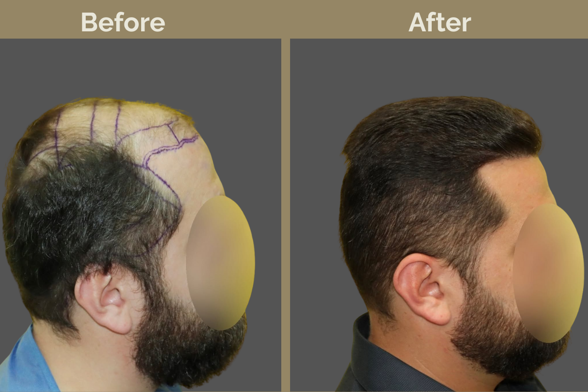 mila services - 2025-12-03T185959.547