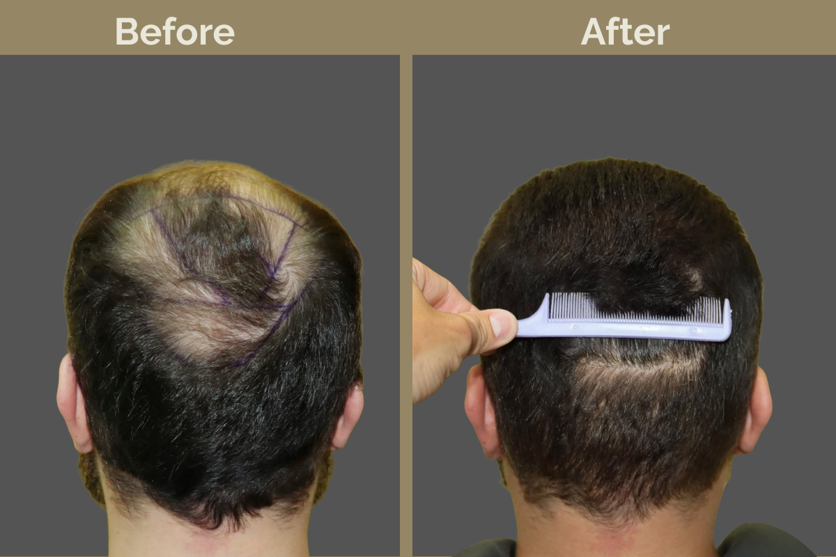 mila services - 2025-12-03T190206.112