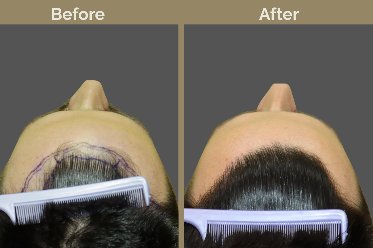 mila services - 2025-12-03T190559.253