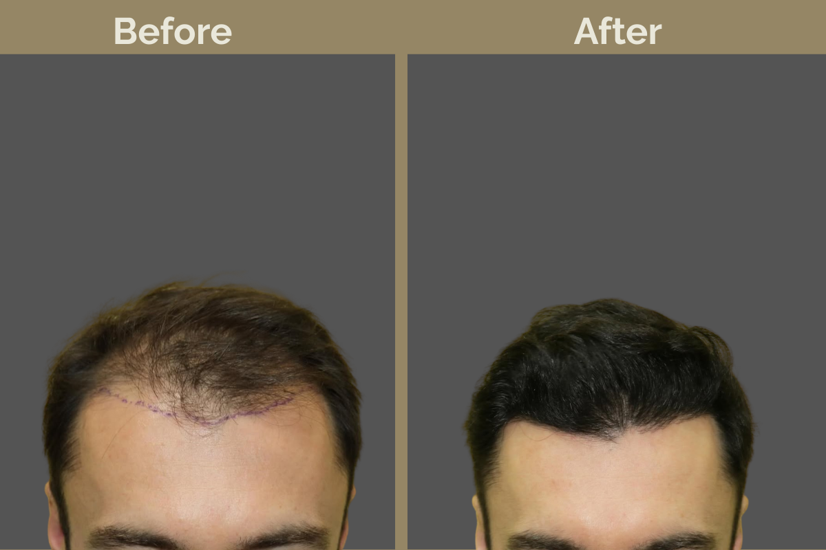 mila services - 2025-12-03T190719.950