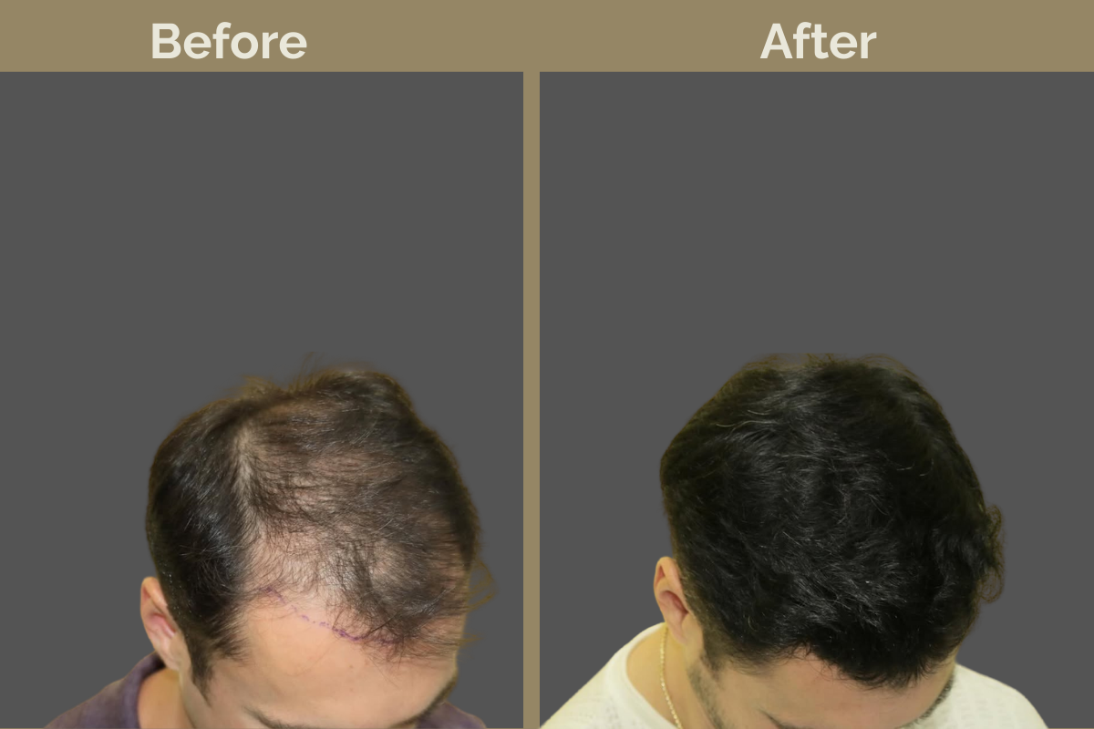 mila services - 2025-12-03T191111.013