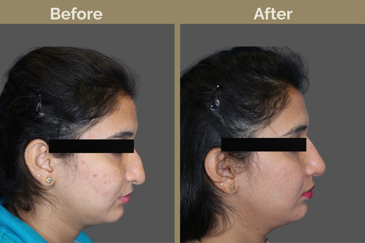 mila services - 2025-12-03T192501.953