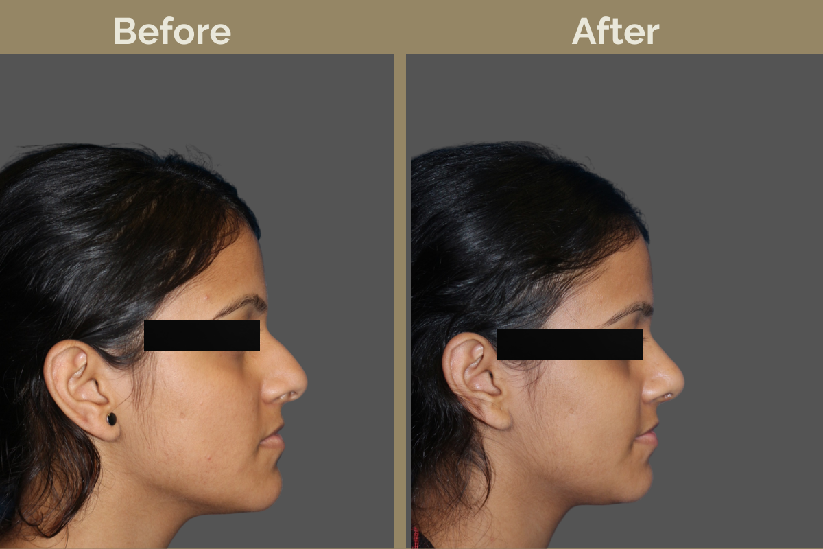 mila services - 2025-12-03T192853.187