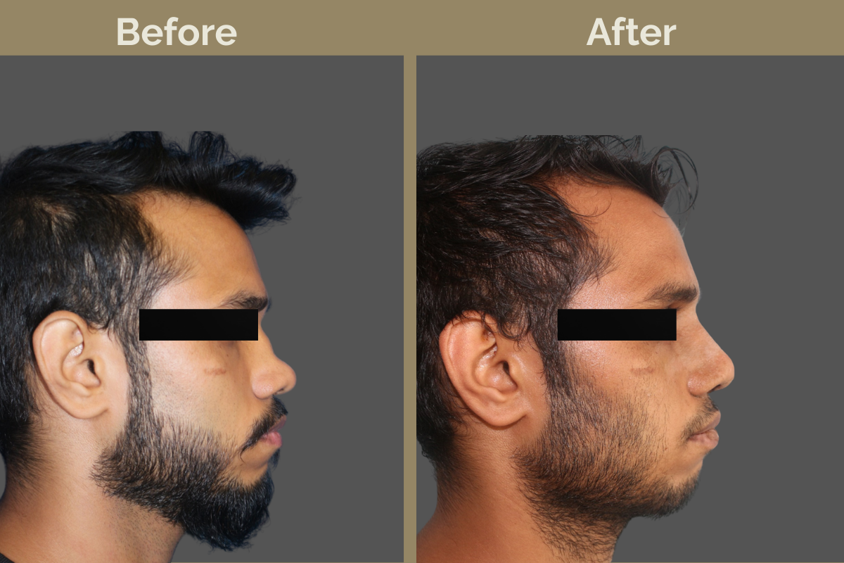 mila services - 2025-12-04T105303.149