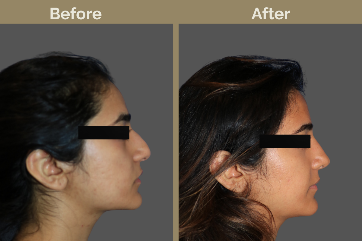 mila services - 2025-12-04T105459.252