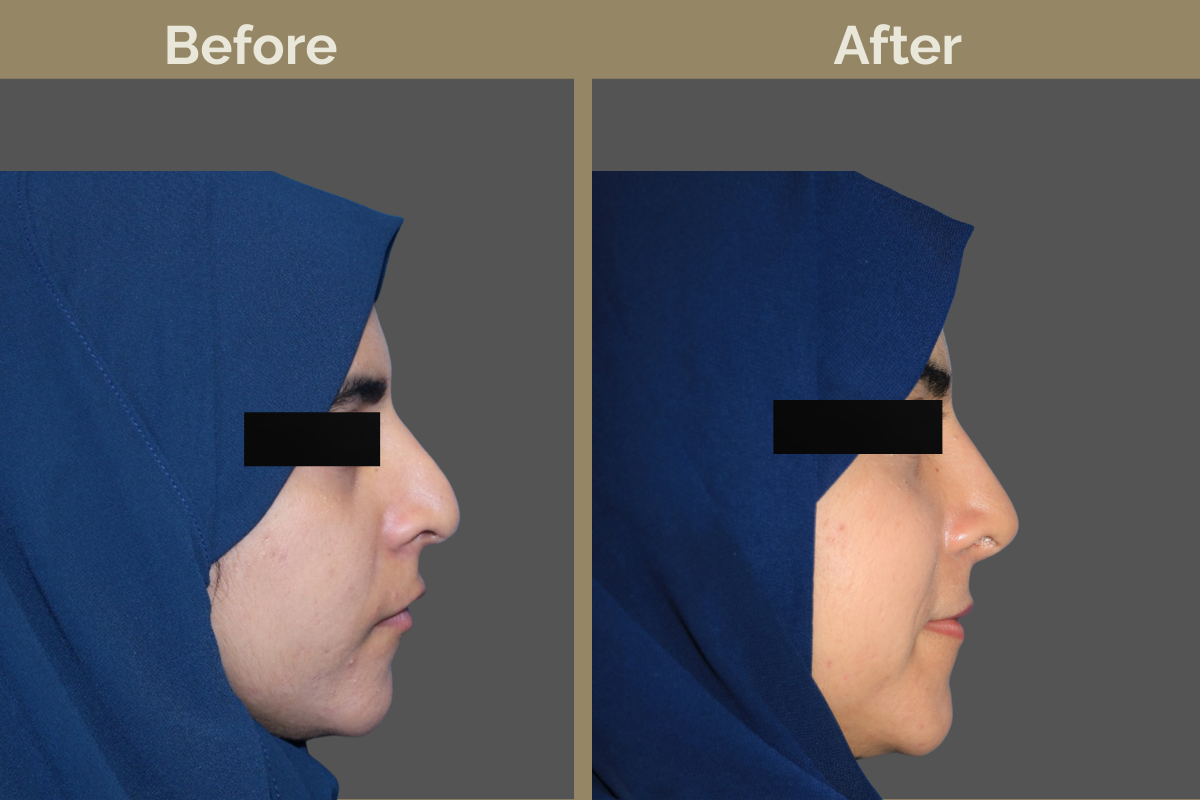 mila services - 2025-12-04T105641.226