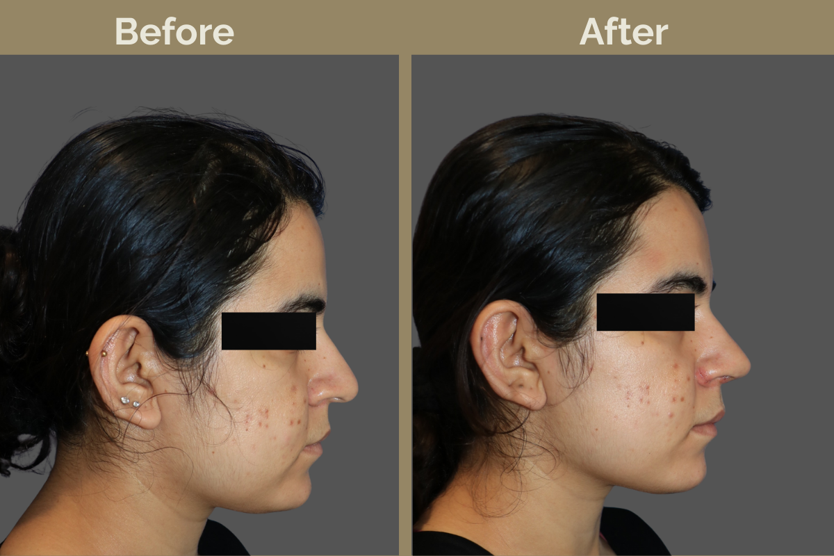 mila services - 2025-12-04T105946.467