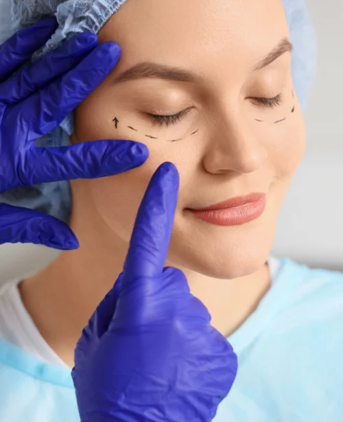 Lower Eyelid Blepharoplasty