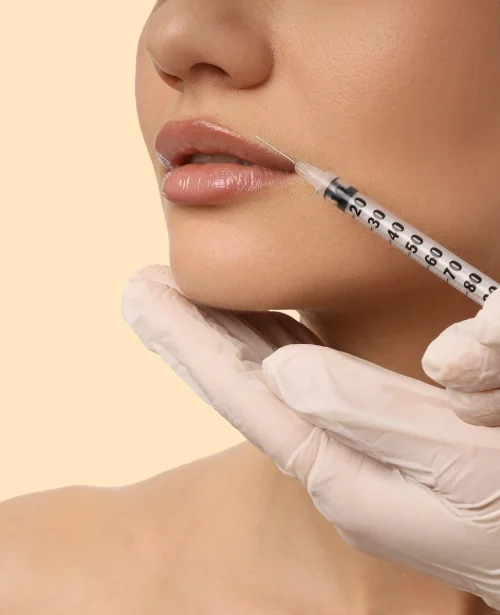 Augmentation with Fillers
