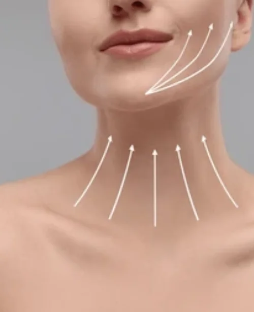 Necklift
