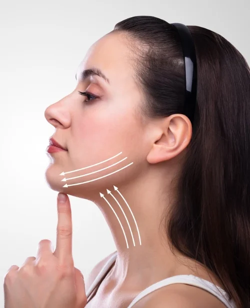 Neck Fat Reduction