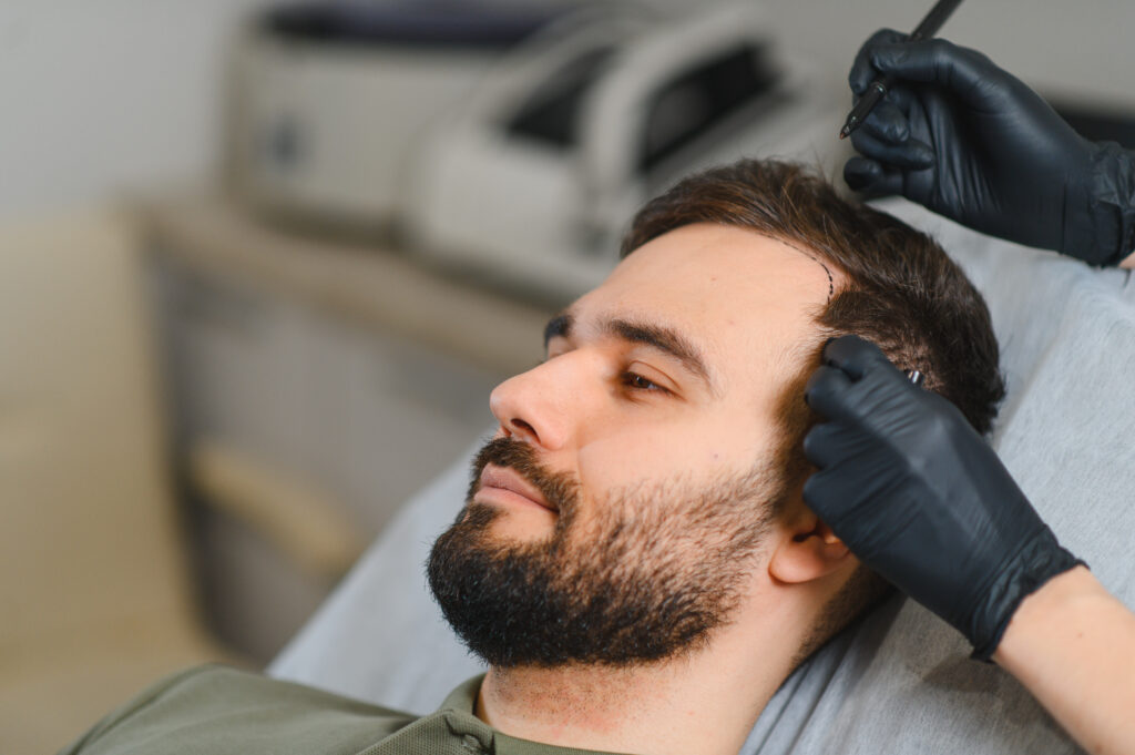 Best Hair Transplant Clinic in Ahmedabad
